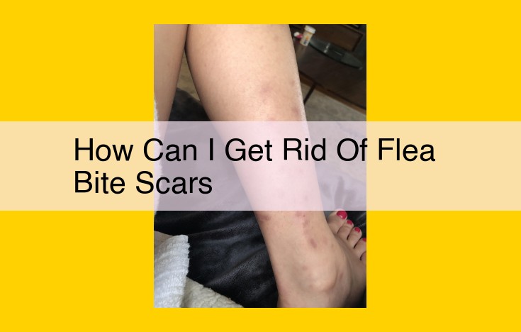 Eliminate Flea Bite Scars: Expert Guidance and Effective Solutions