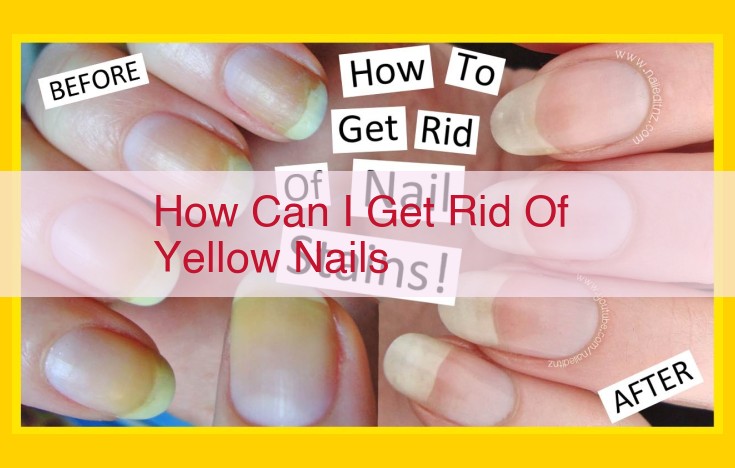 Home Remedies and Medical Options for Effective Nail Fungus Treatment