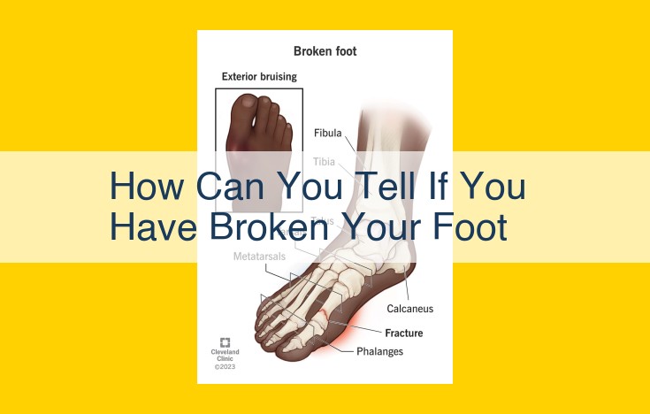 Foot Fractures: Symptoms, Causes, and Treatment