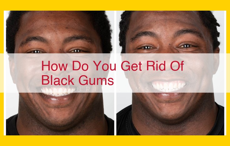 Gum Discoloration: Causes and Treatment Options for Blackened Gums