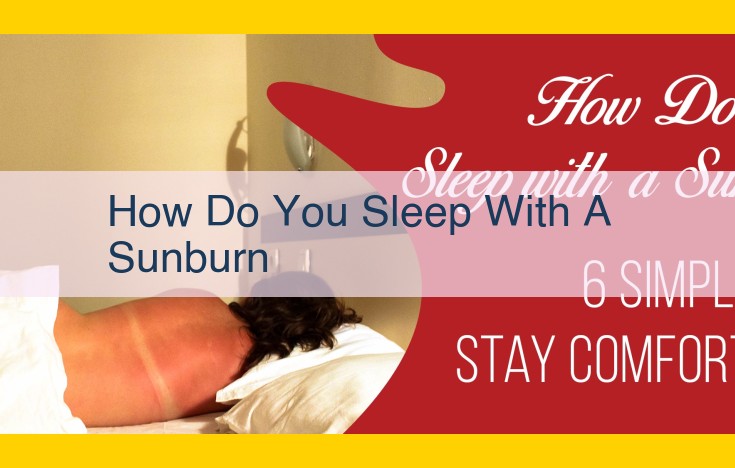 Sunburn Relief: Sleep Better and Recover Faster