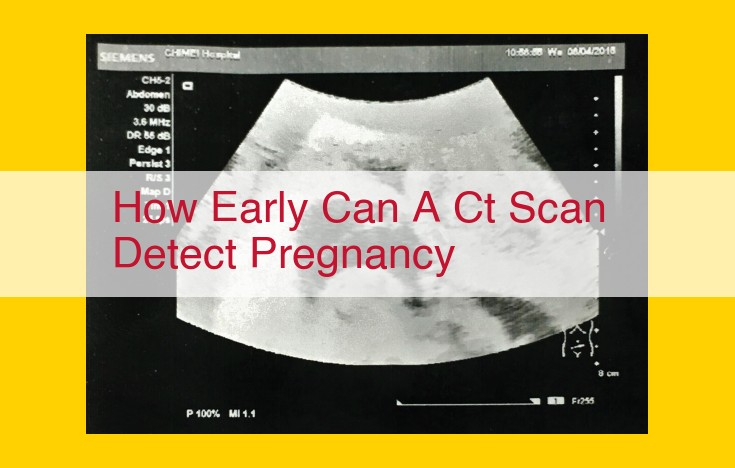 Is a CT Scan Safe for Pregnancy?