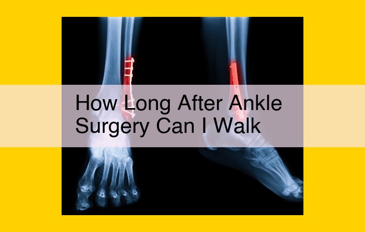 Comprehensive Rehabilitation Timeline for Walking After Ankle Surgery