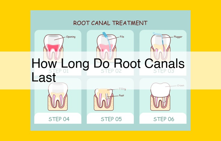 Root Canal Longevity: Factors Influencing the Success and Lifespan of Dental Procedures