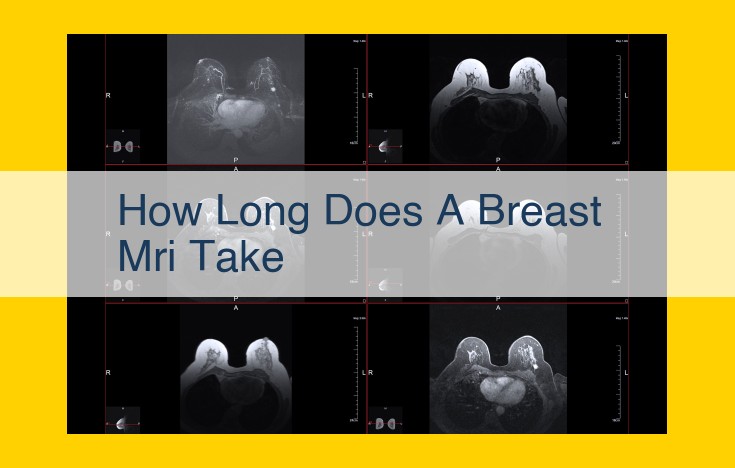 Breast MRI Scan Duration: Factors Affecting Total Time and Optimization Tips