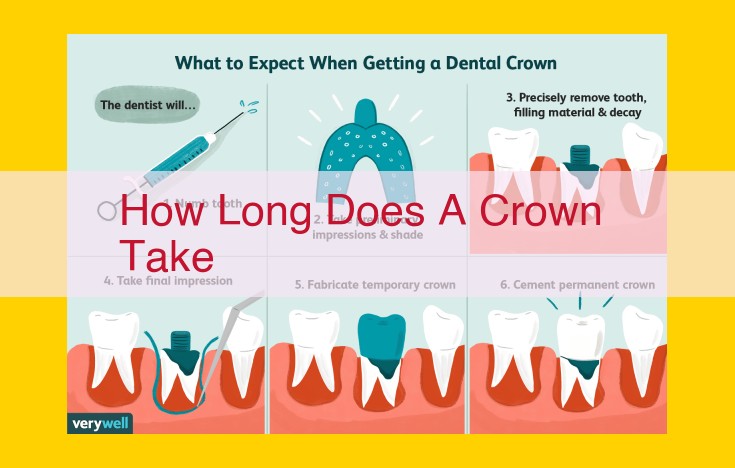 Understanding Crown Placement Duration: Factors and Timeline