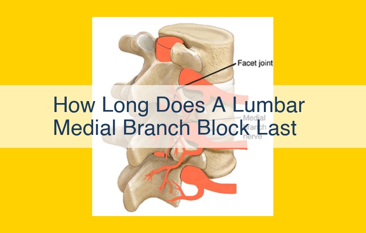 Lumbar Medial Branch Block (LMBB): Duration and Types of Effects