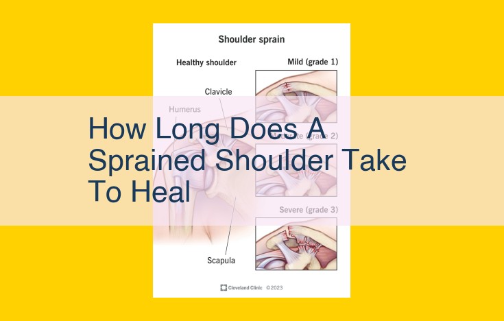 Shoulder Sprains: Recovery Timelines and Treatment Options