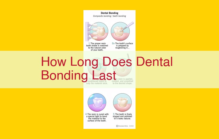 Dental Bonding Longevity: Factors Affecting Lifespan and Importance of Oral Hygiene