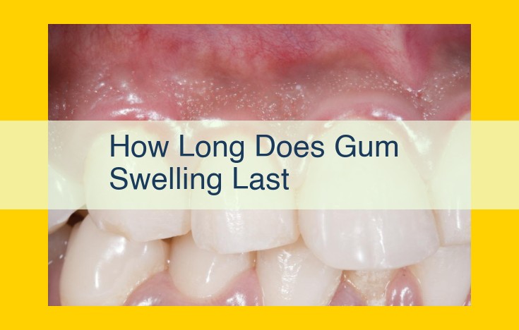 Gum Swelling: Duration and Treatment Options for Gingivitis and Periodontitis