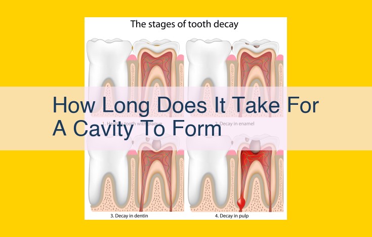 Understand Dental Caries: Formation, Prevention, and Oral Health Maintenance