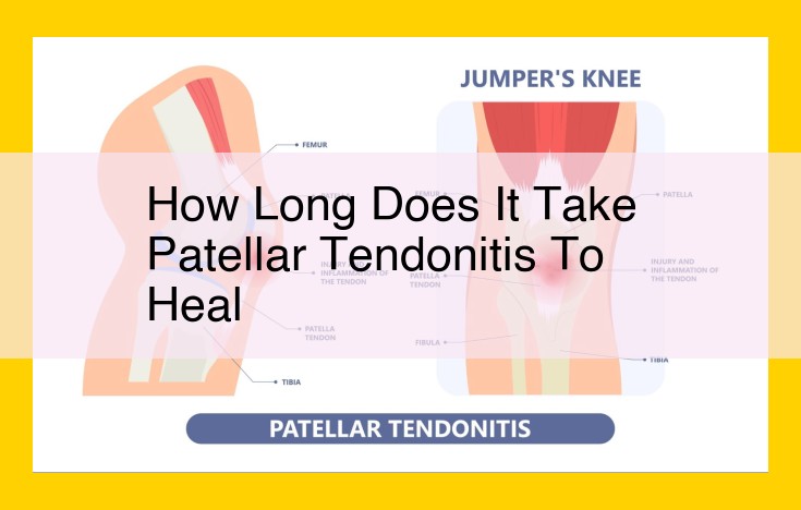 Patellar Tendonitis Recovery Time: How Long Does It Take to Heal?