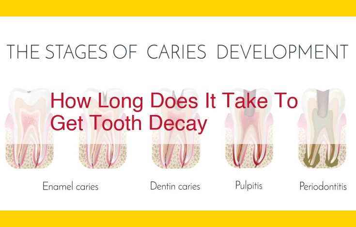 Demystifying Tooth Decay: Understanding the Role of Plaque, Acids, and Sugar