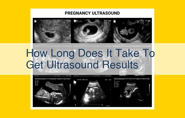 Timeframe for Ultrasound Results: How Long to Wait for Your Report