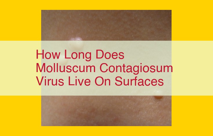 How Long Does Molluscum Contagiosum Virus Survive on Surfaces? (Comprehensive Guide)