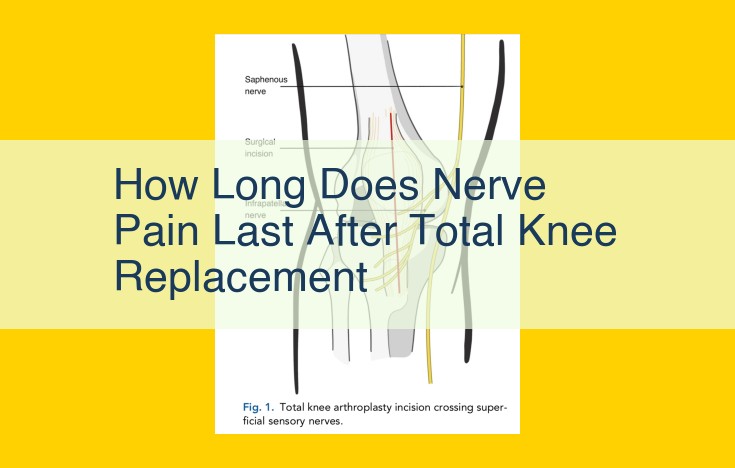 Understanding Nerve Pain After Total Knee Replacement: Duration, Severity, and Treatment Options