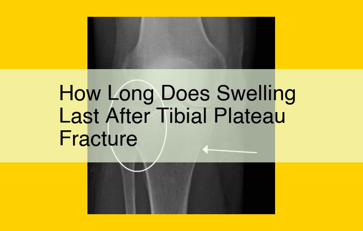 Essential Guide to Managing Swelling After Fractures: Factors, Duration, and Treatment