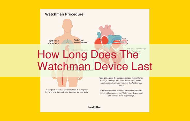 WATCHMAN Device: Clinical Trial Data for Stroke Prevention in Atrial Fibrillation