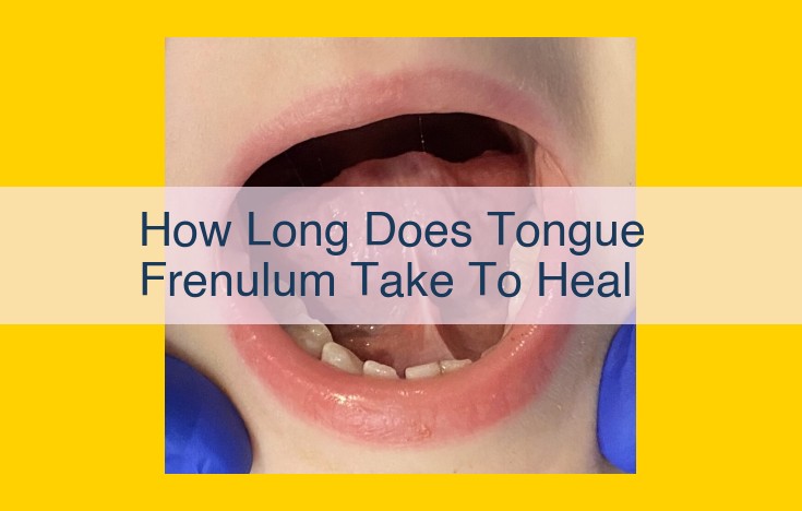 Tongue Frenulum Healing Time: Essential Information Missing