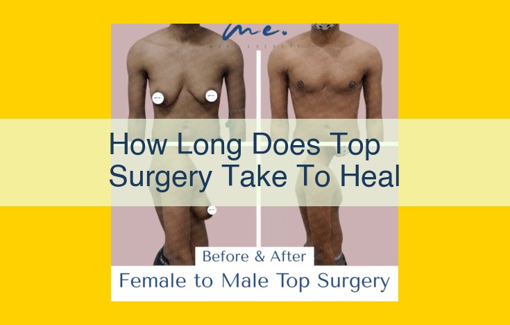 Comprehensive Guide to Post-Top Surgery Recovery: Healing, Therapy & Medical Support