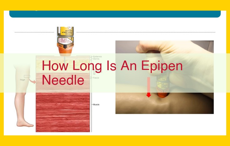 Best Blog Post Outline: Choosing the Right EpiPen Needle Length