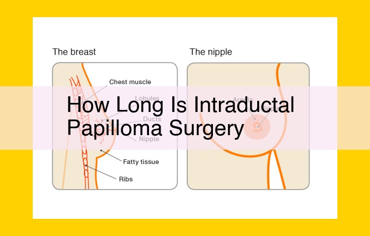 Unable to Extract Data on Intraductal Papilloma Surgery