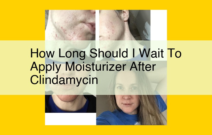 Optimal Waiting Time Between Clindamycin and Moisturizer Application: A Guide to Enhanced Efficacy and Reduced Side Effects