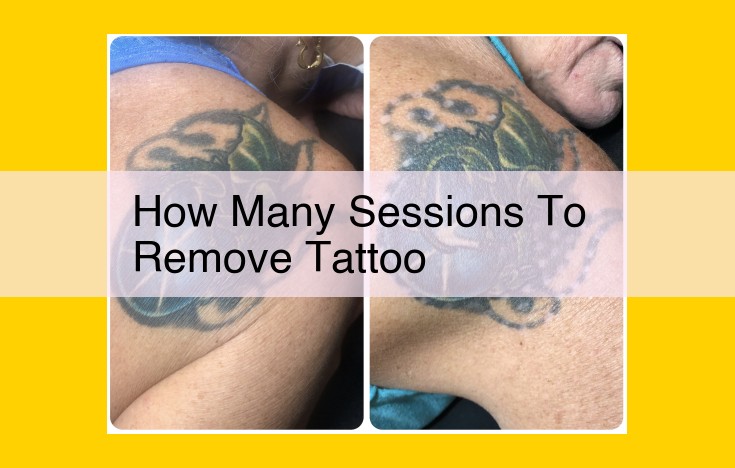 Comprehensive Guide to Tattoo Removal: Understanding Factors, Techniques, and Best Practices