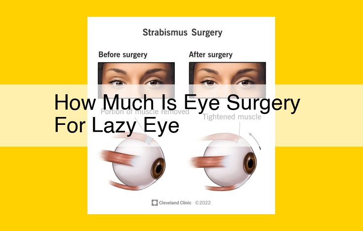 Eye Surgery for Lazy Eye: Patient Guide to Costs