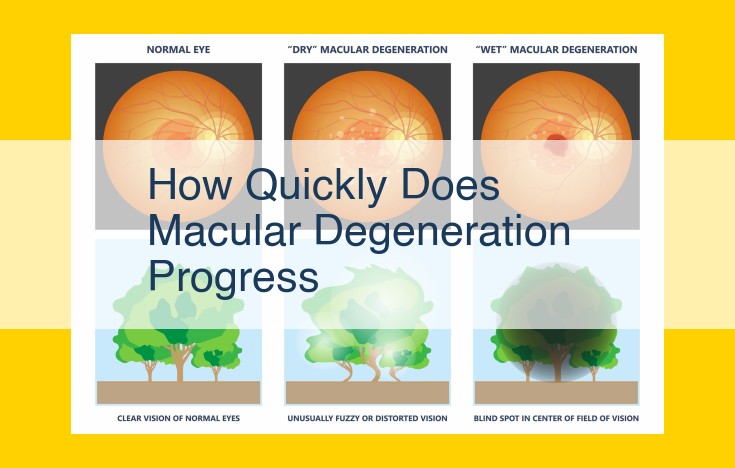 Understanding Macular Degeneration: Progression, Signs, and Importance of Early Detection