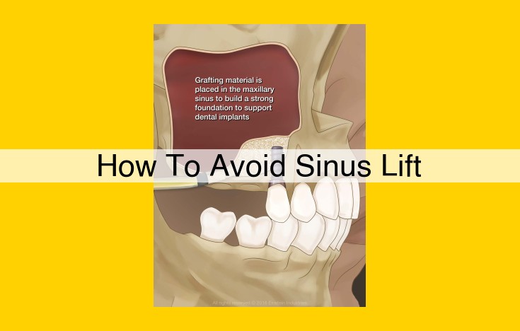 Sinus Lift Surgery Avoidance: Prioritizing Oral and Sinus Health
