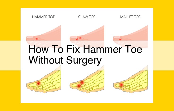 Hammer Toe: Non-Surgical Treatment Options and Preventive Measures