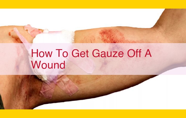 Step-by-Step Guide: How to Safely Remove Gauze from a Wound