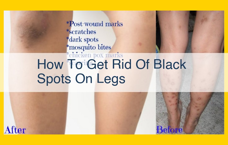 Discover Effective Methods for Removing Black Spots on Legs: Exfoliation, Lightening Creams, and Beyond