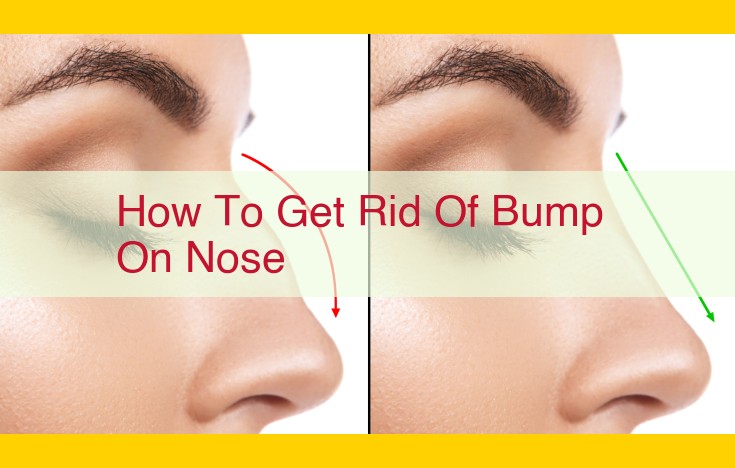 Effective Nose Bump Removal: Consult Specialists and Enhance Skin Health