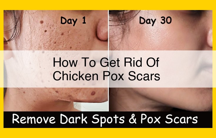 Eliminate Chicken Pox Scars: Laser Therapy, Microneedling, Chemical Peels, and Natural Remedies