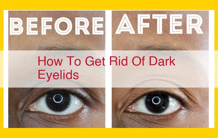 Natural Remedies and Sun Protection Tips to Lighten Dark Eyelids