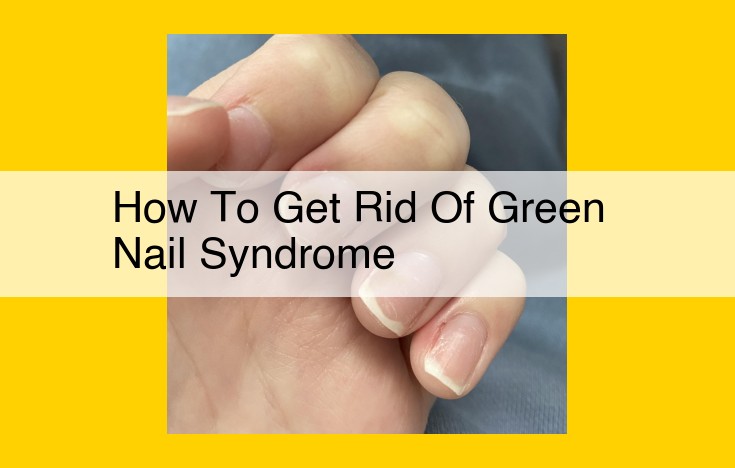 Green Nail Syndrome: Causes, Symptoms, and Effective Treatments