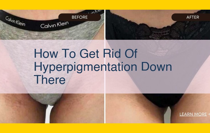 Comprehensive Guide to Hyperpigmentation: Causes, Treatments, and Prevention