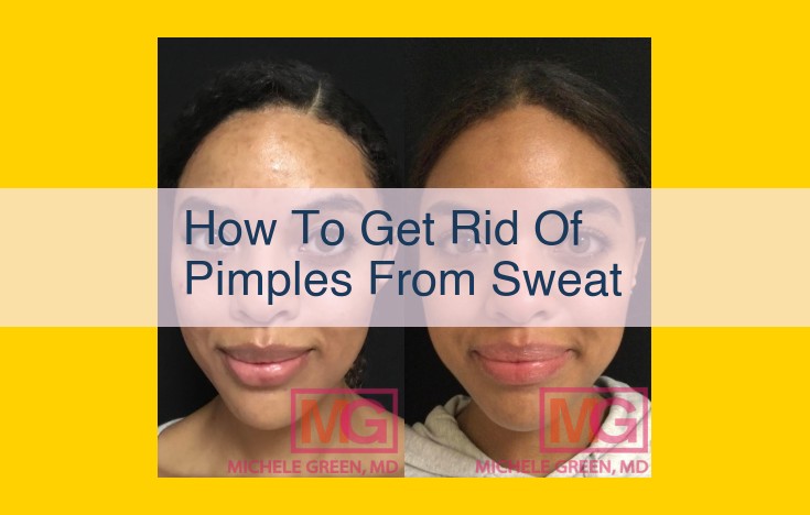 Eliminate Sweat-Induced Acne: A Comprehensive Guide to Effective Treatment