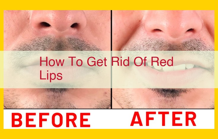 Definitive Guide to Eliminating Red Lips: Solutions and Expert Advice