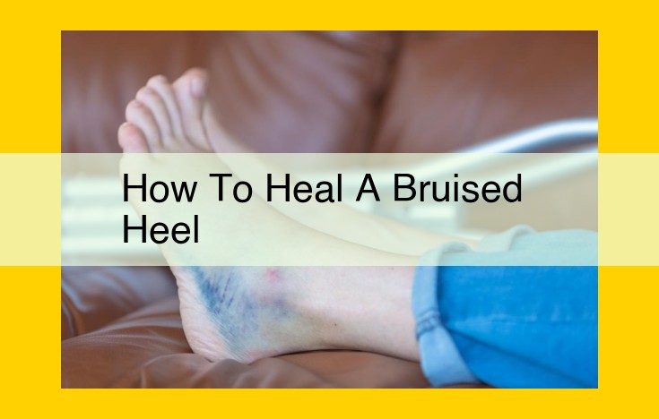 Heal Your Bruised Heel: Comprehensive Guide from Professionals to Home ...