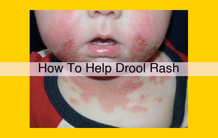 How to Treat Drool Rash Effectively: A Comprehensive Guide