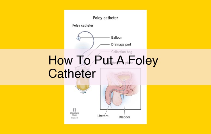 Step-by-Step Guide to Foley Catheter Insertion: A Comprehensive Guide for Healthcare Professionals