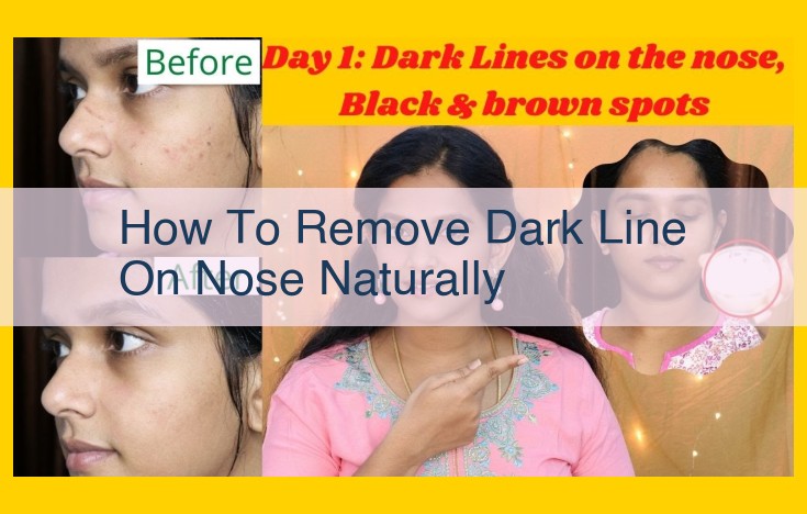 Natural and Medical Solutions to Banish the Dark Line on Your Nose