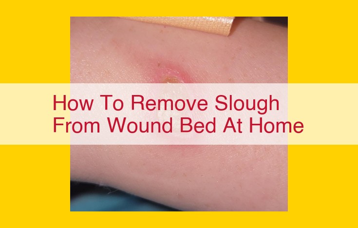 Comprehensive Guide to Effective Slough Removal from Wound Beds at Home