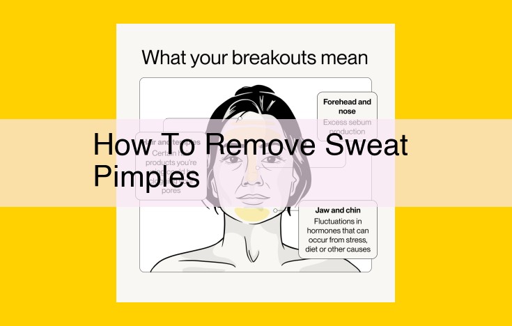 Ultimate Guide to Treating and Preventing Sweat Pimples: Expert Tips for Clear Skin