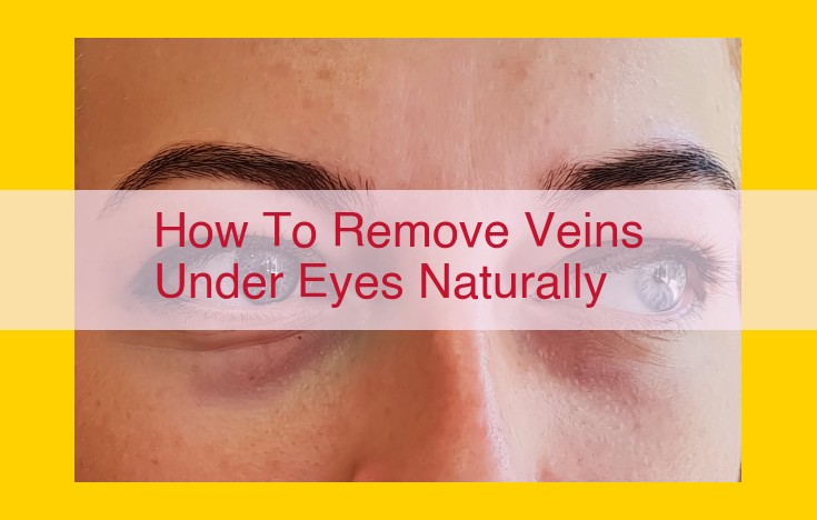 Diminish Under-Eye Veins: Medical Treatments, Natural Remedies, and Topical Solutions