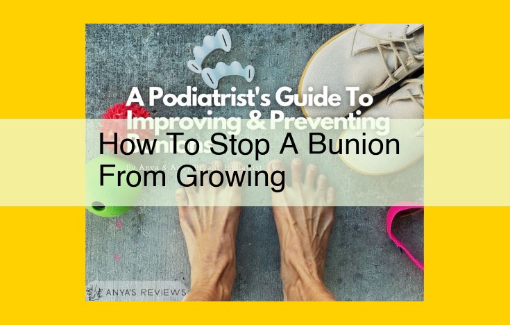 Preventing and Managing Bunions: A Comprehensive Guide