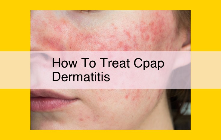 CPAP Dermatitis Treatment: Addressing Skin Irritation Effectively